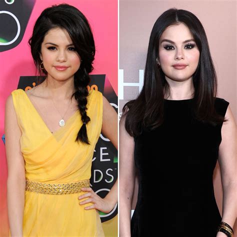 selena gomez boobs before and after|Selena Gomez Breast Implant Plastic Surgery Before And After。